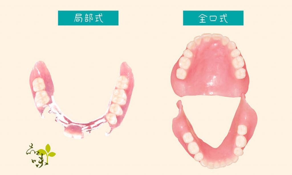 選擇活動假牙前　先知道這些事